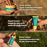 My Trusty Sunflower Hand Cream 100ml For Dry Skin Eczema Vegan Bergamot Neroli view 7