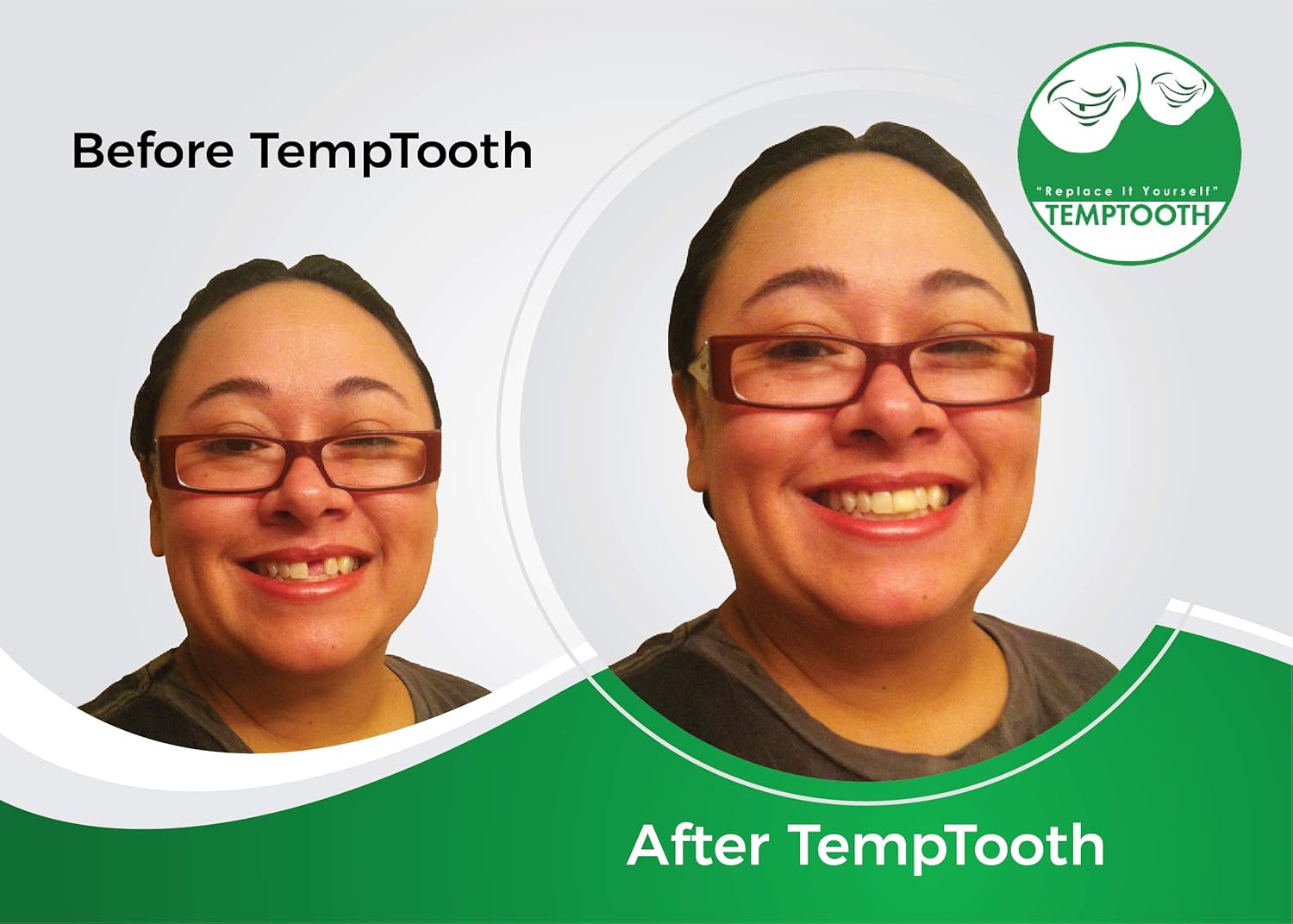 Temptooth #1 Seller Trusted Patented Temporary Tooth Replacement Product: Health & Personal Care