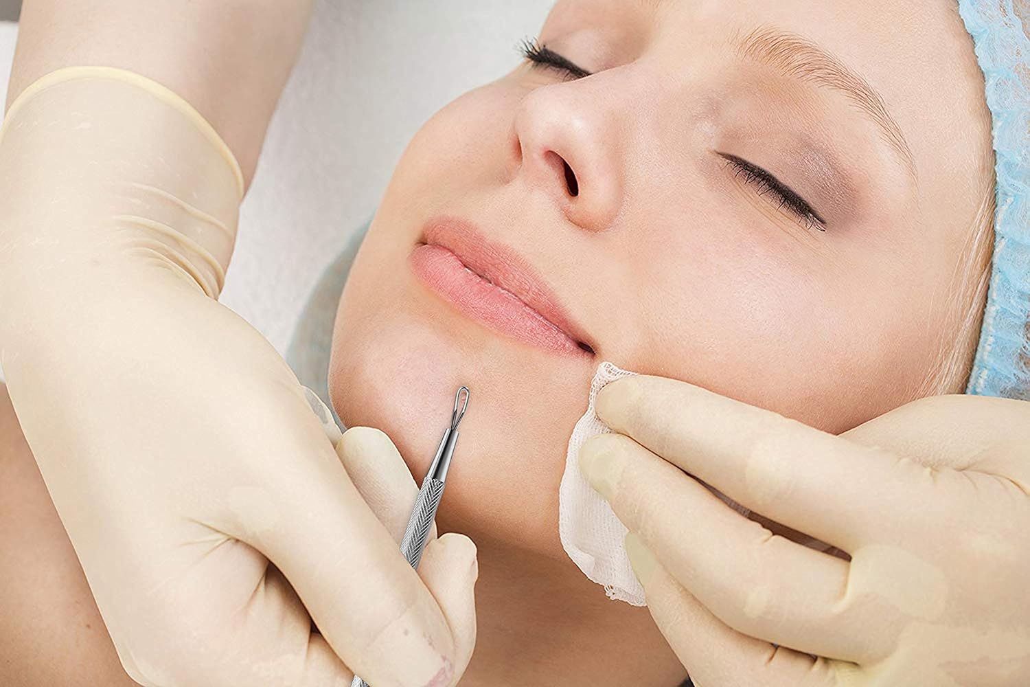 Professional Blackhead and Blemish Remover - Pimple Comedone Removal 2-In-1 Extractor Tool (Round): Beauty
