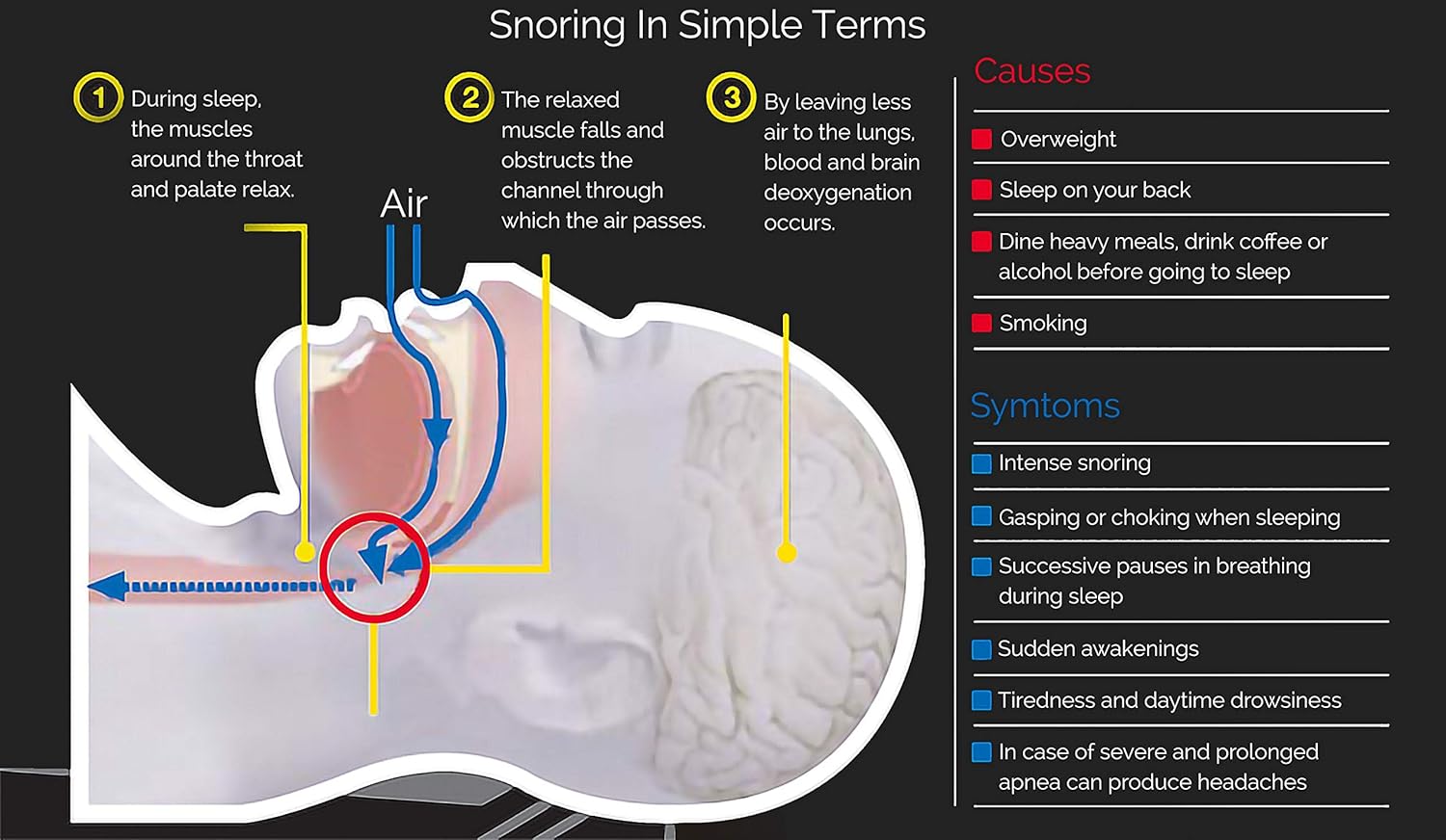 New 2019 Sleep Lab's Best Anti Snoring Chin Strap, Soft, Breathable Material, Voted Best Snore Strap in North America, Anti Snoring Devices, Anti-Snore Strip, Sleep Aid for Men, Women and Cpap Users: Health & Personal Care