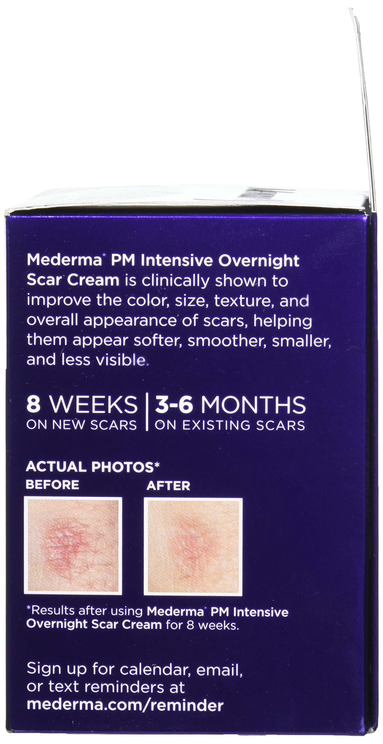 Mederma PM Intensive Overnight Scar Cream Works with Skin's Nighttime