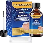 sanuscode 17% Salicylic Acid Wart Remover Liquid,Fast-Acting Freeze Off Wart Removal Kit,Treatment for Plantar and Common Warts,Corns and Calluses,Gentle for All Skin Types for Adult(30 ml)
