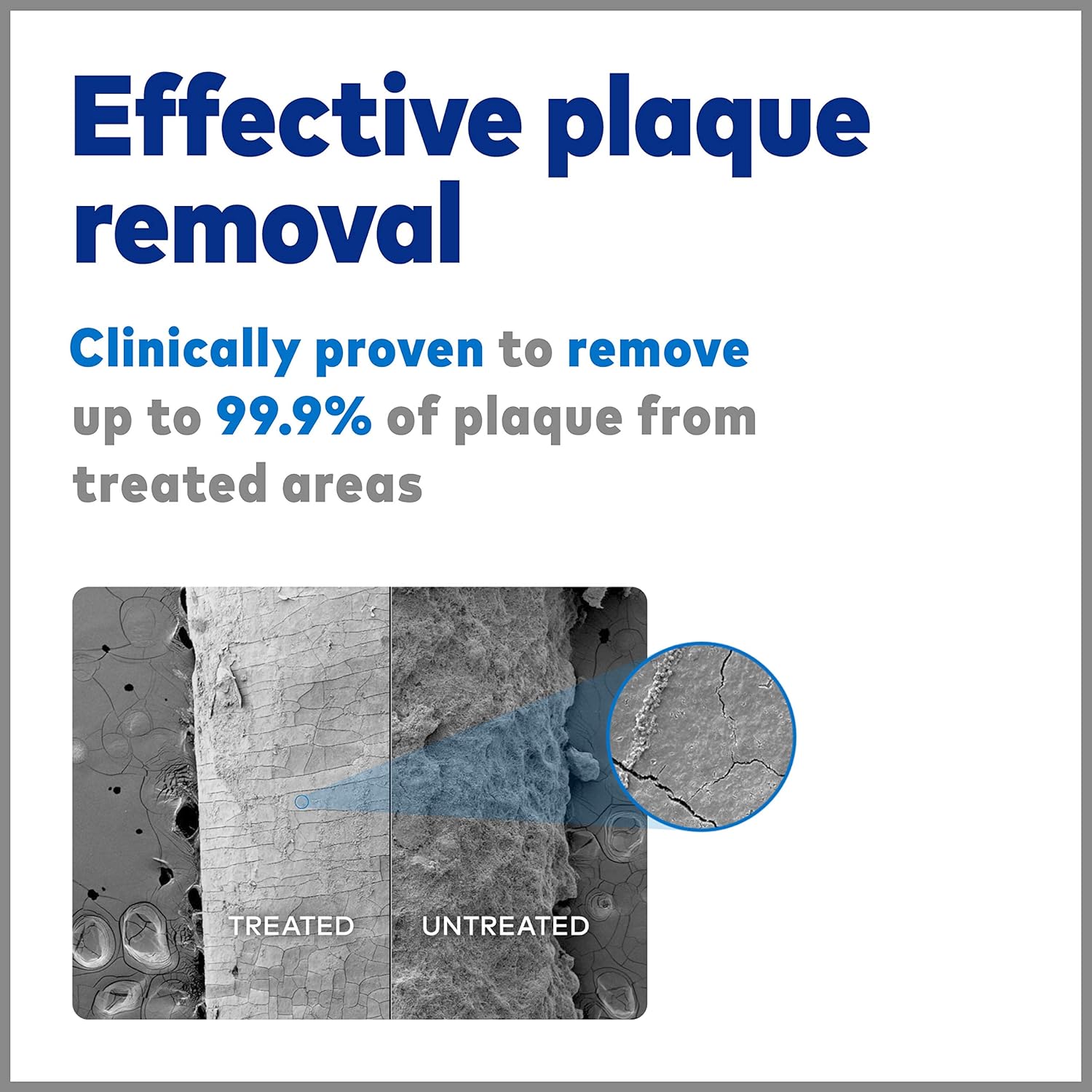 Waterpik Cordless Water Flosser, Battery Operated & Portable for Travel & Home, ADA Accepted Cordless Express, White WF-02: Beauty