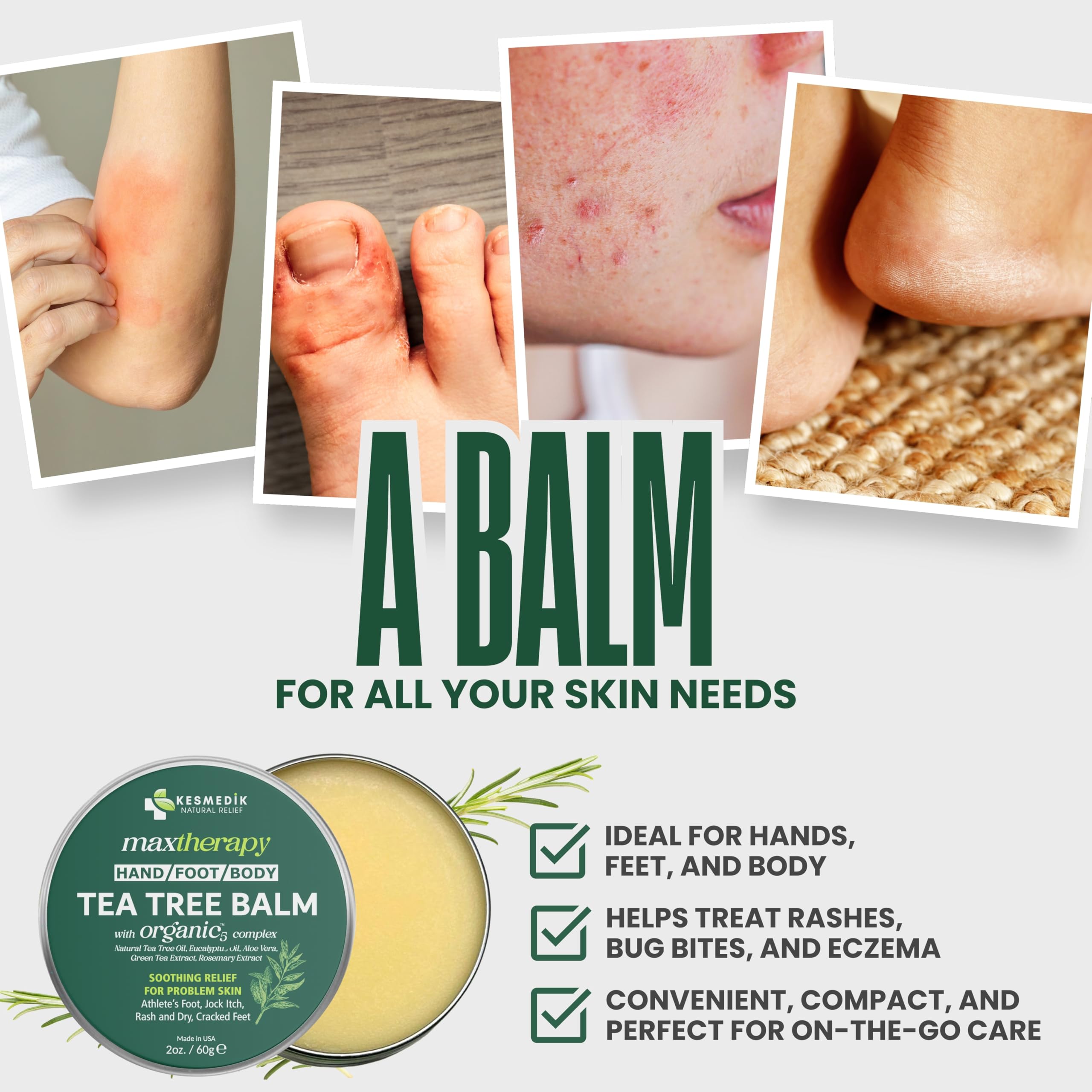 KESMEDIK Tea Tree Oil MaxTherapy Balm, Itchy Skin Relief, Soothing for Rashes, Jock Itch, Athlete’s Foot, Chafing, Insect Bites, Folliculitis, Dry Sensitive Skin, Effective & Safe for All Ages, 2-Pack