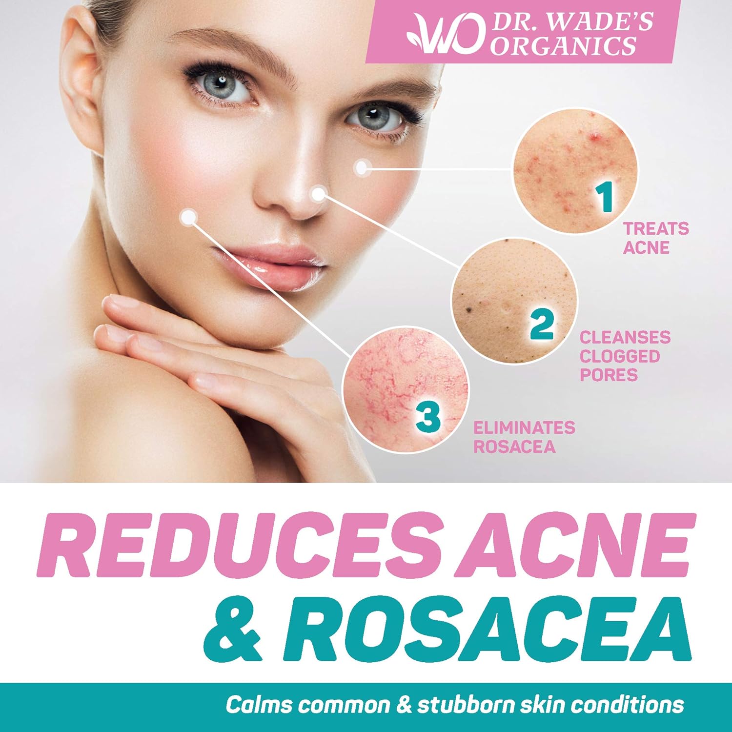 Acne Treatment Serum - Natural Skin Care Serum for Acne and Dark Spots with Niacinamide, Tea Tree Oil, Hyaluronic Acid & Tamanu Oil - Effective Rosacea Treatment - Acne Serum for Oily Skin: Beauty