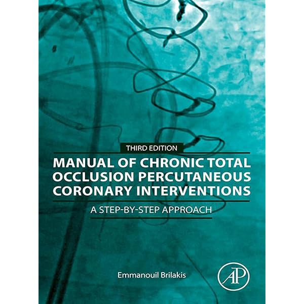 Amazon.com: Mastering Structural Heart Disease eBook : de Marchena