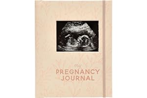 Pearhead Little Bundle of Joy Pregnancy Journal, Keepsake Pregnancy Memory Book with Sonogram Photo, First Through Third Trim
