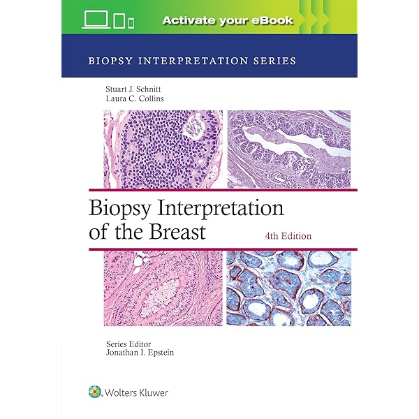 Rosen's Breast Pathology: 9781496398918: Medicine & Health Science