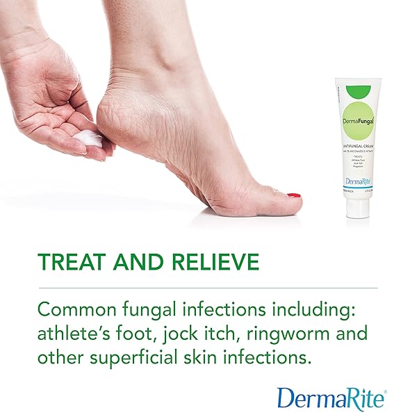 DERMAFUNGAL ANTIFUNGAL CREAM – TREATS AND PREVENTS MOST ATHLETE’S FOOT, JOCK ITCH, AND RINGWORM – 2% MICONAZOLE NITRATE – 3.75 OZ TUBE