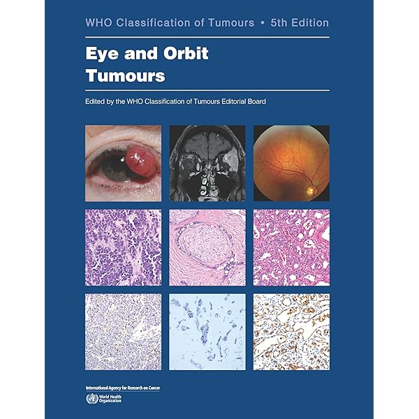 Thoracic Tumours: WHO Classification of Tumours: 9789283245063