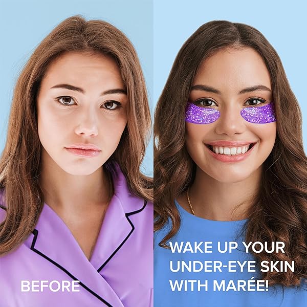 MAREE EYE GELS – COOLING PADS UNDER EYE PATCHES FOR PUFFY EYES AND DARK CIRCLES WITH COLLAGEN & HYALURONIC ACID – ANTI WRINKLES UNDER EYE MASKS SKINCARE TREATMENT FOR PUFFINESS – PARCHES PARA OJERAS