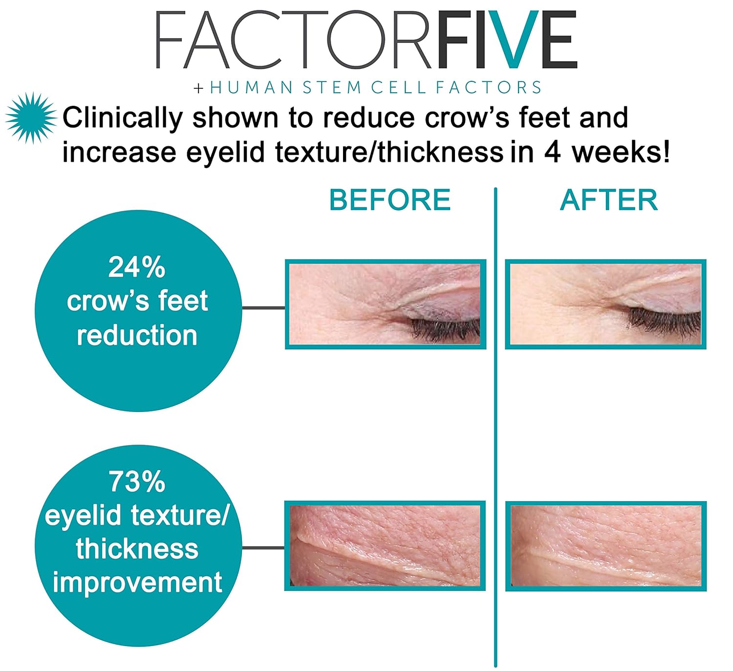 factorfive eye and lash cream