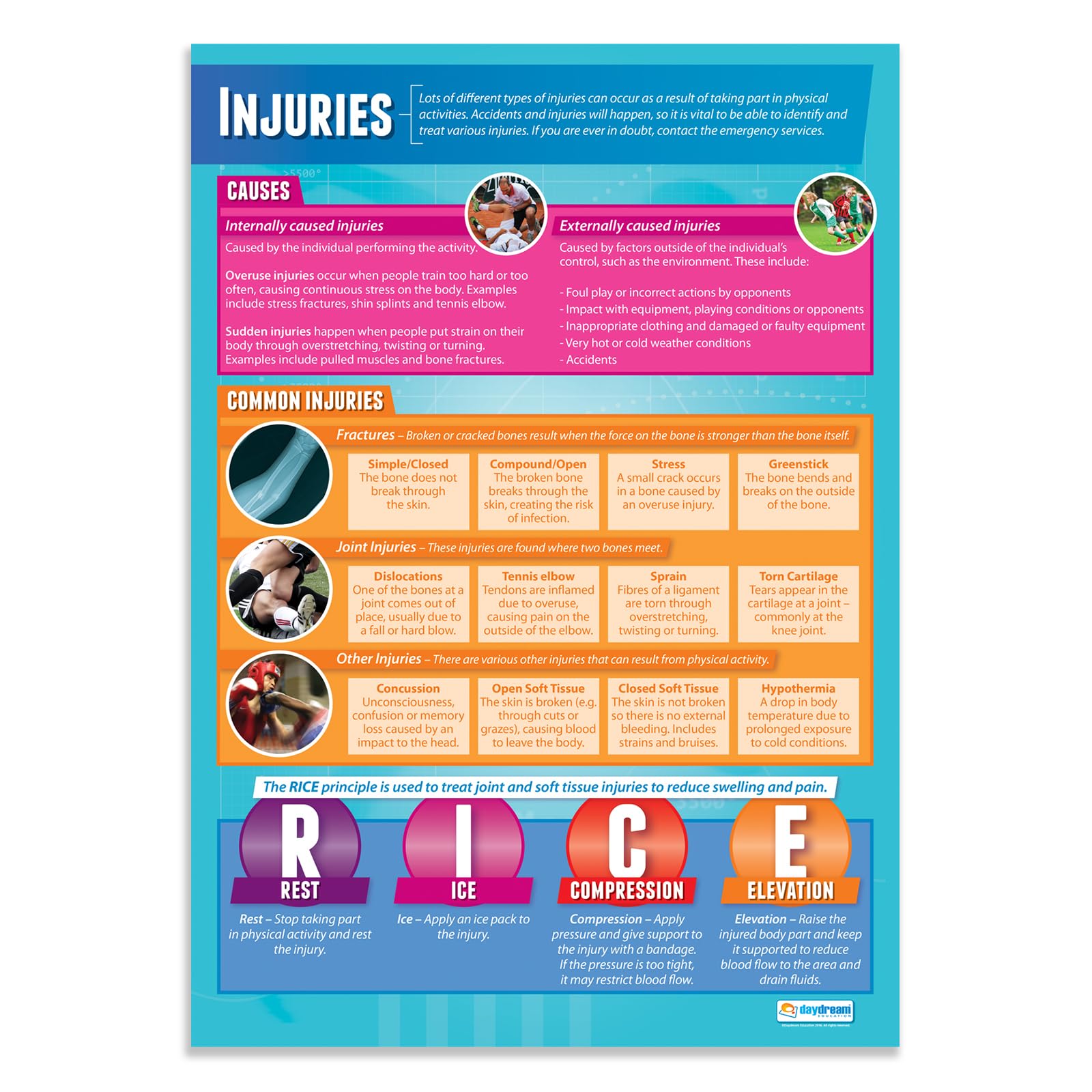 Daydream Education Injuries | PE Posters | Laminated Gloss Paper measuring 850mm x 594mm (A1) | Physical Education Charts for the Classroom | Education Charts