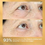 StriVectin Tighten & Lift Hyperlift Eye Cream 0.34 Oz 10ml Instant Eye Fix view 7