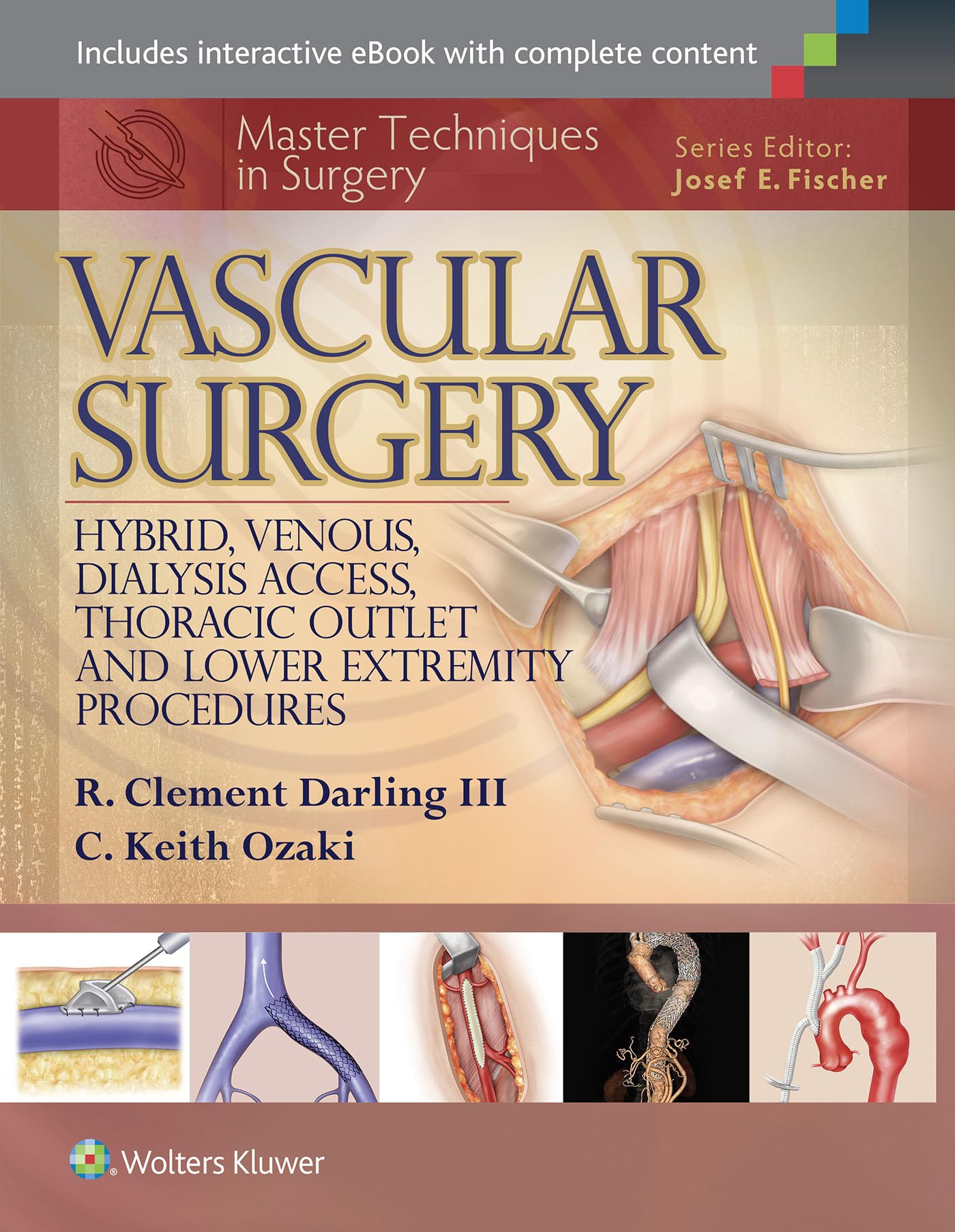 Mua Master Techniques in Surgery: Vascular Surgery: Hybrid, Venous ...
