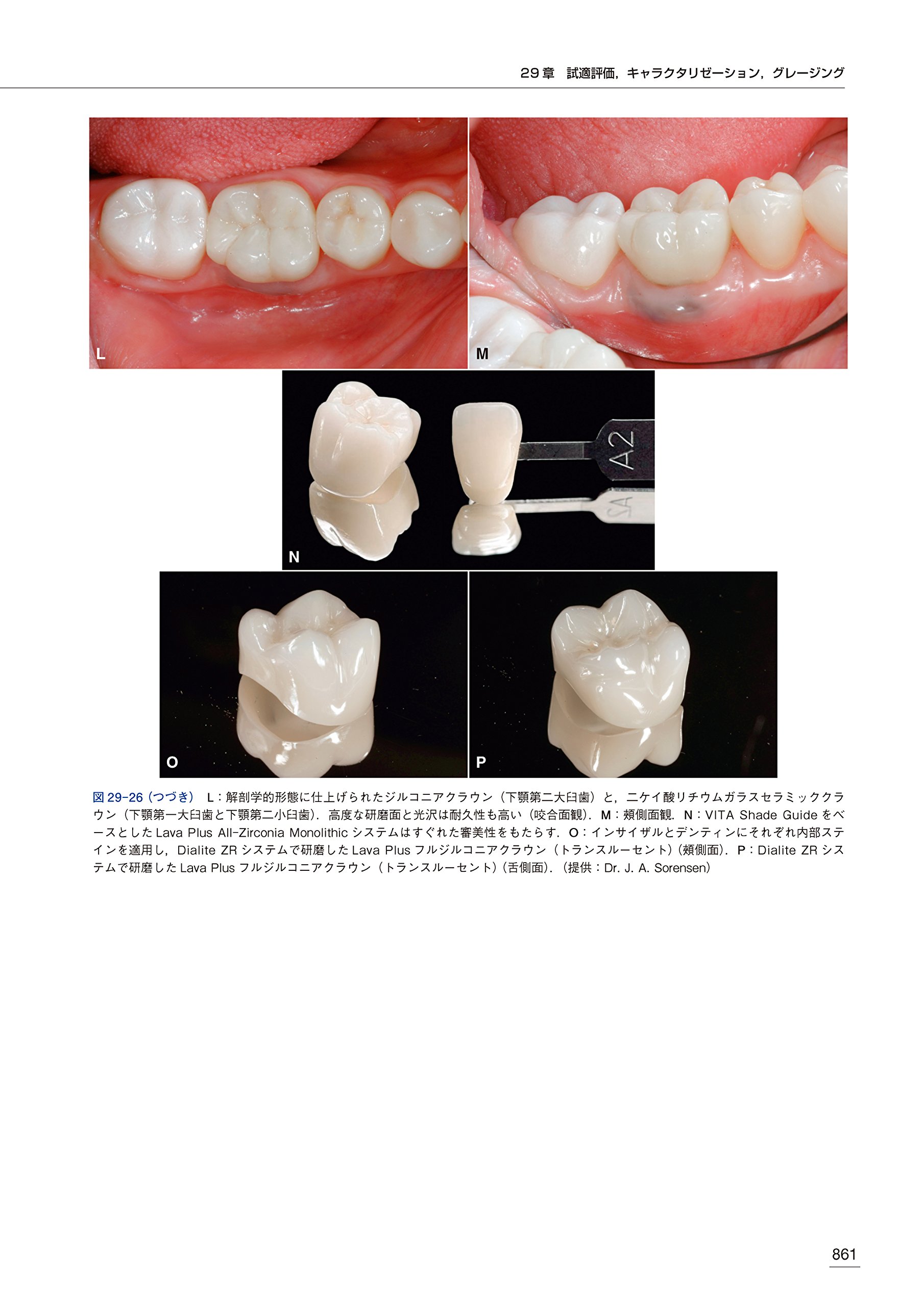 クラウンブリッジの臨床 原著第5版 Stephen F Rosenstiel Martin F Land Junhei Fujimoto 藤本 浩平 岡村 光信 廣瀬 正法 錦織 淳 本 通販 Amazon