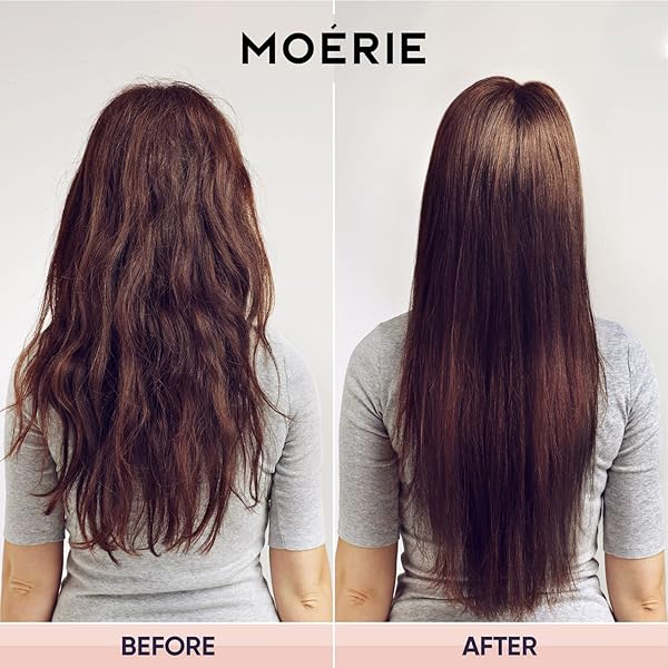 MOERIE ULTIMATE HAIR GROWTH CONDITIONER – FOR LONGER, THICKER, FULLER HAIR – VEGAN FRIENDLY VOLUMIZING HAIR PRODUCTS – PARABEN & SILICONE FREE – ALL HAIR TYPES – REVERSE HAIR LOSS – 8.45 FL OZ (250ML)