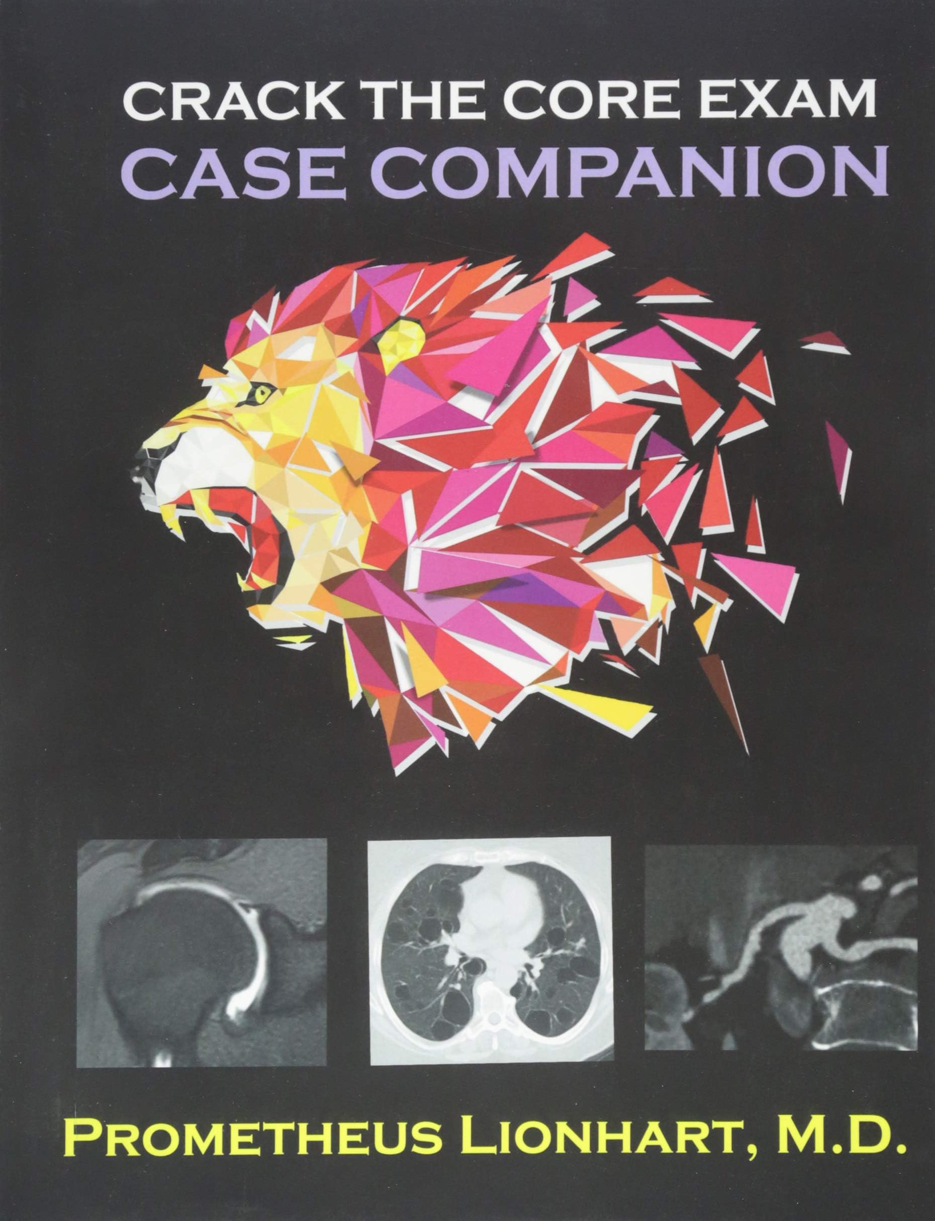 Crack the CORE Exam Case Companion Pricepulse