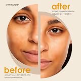 Artnaturals Kojic Acid Soap & African Net Sponge 2x142g Turmeric Dark Spots view 4