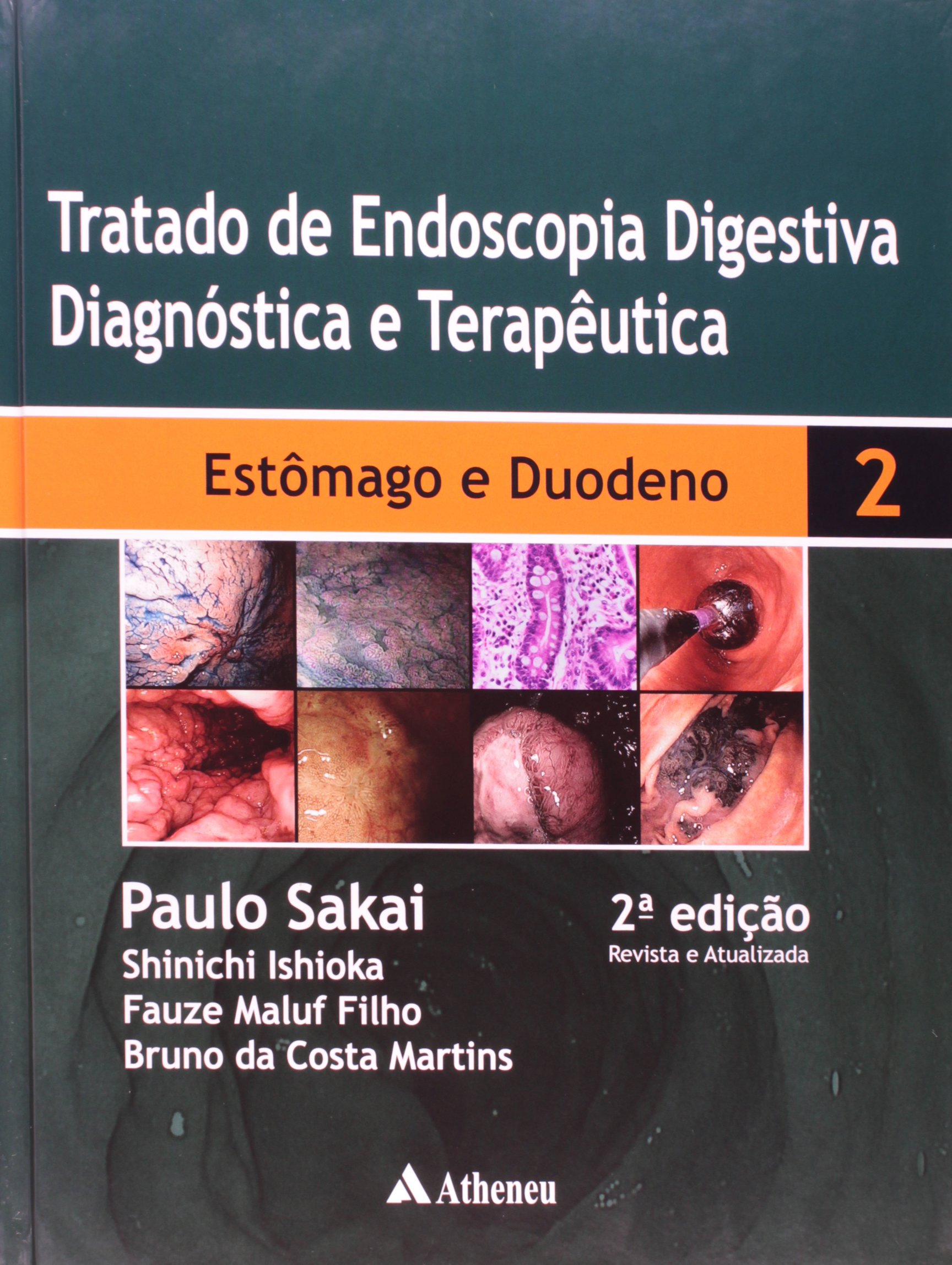 Seriografia De Esôfago Estômago E Duodeno Codigo