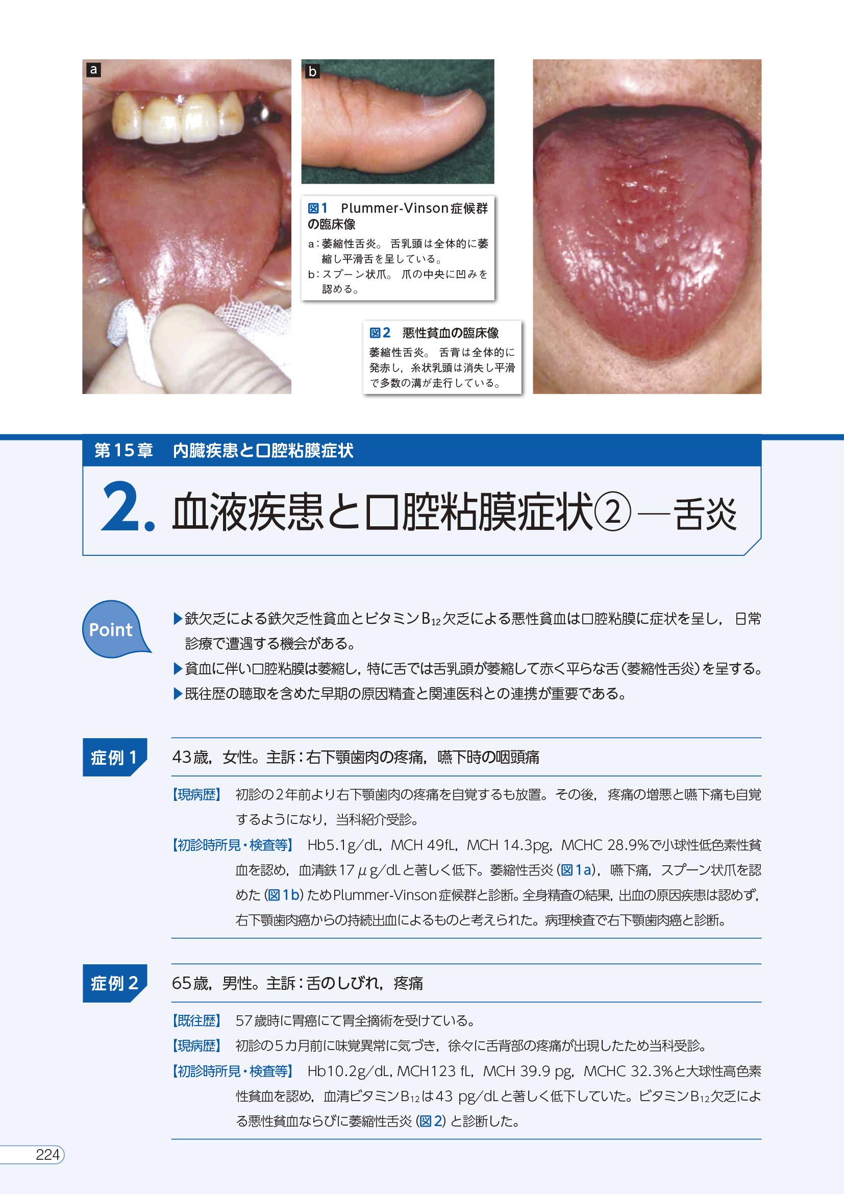 カラーアトラス 皮膚症状110症例でみる内科疾患【電子版付き 