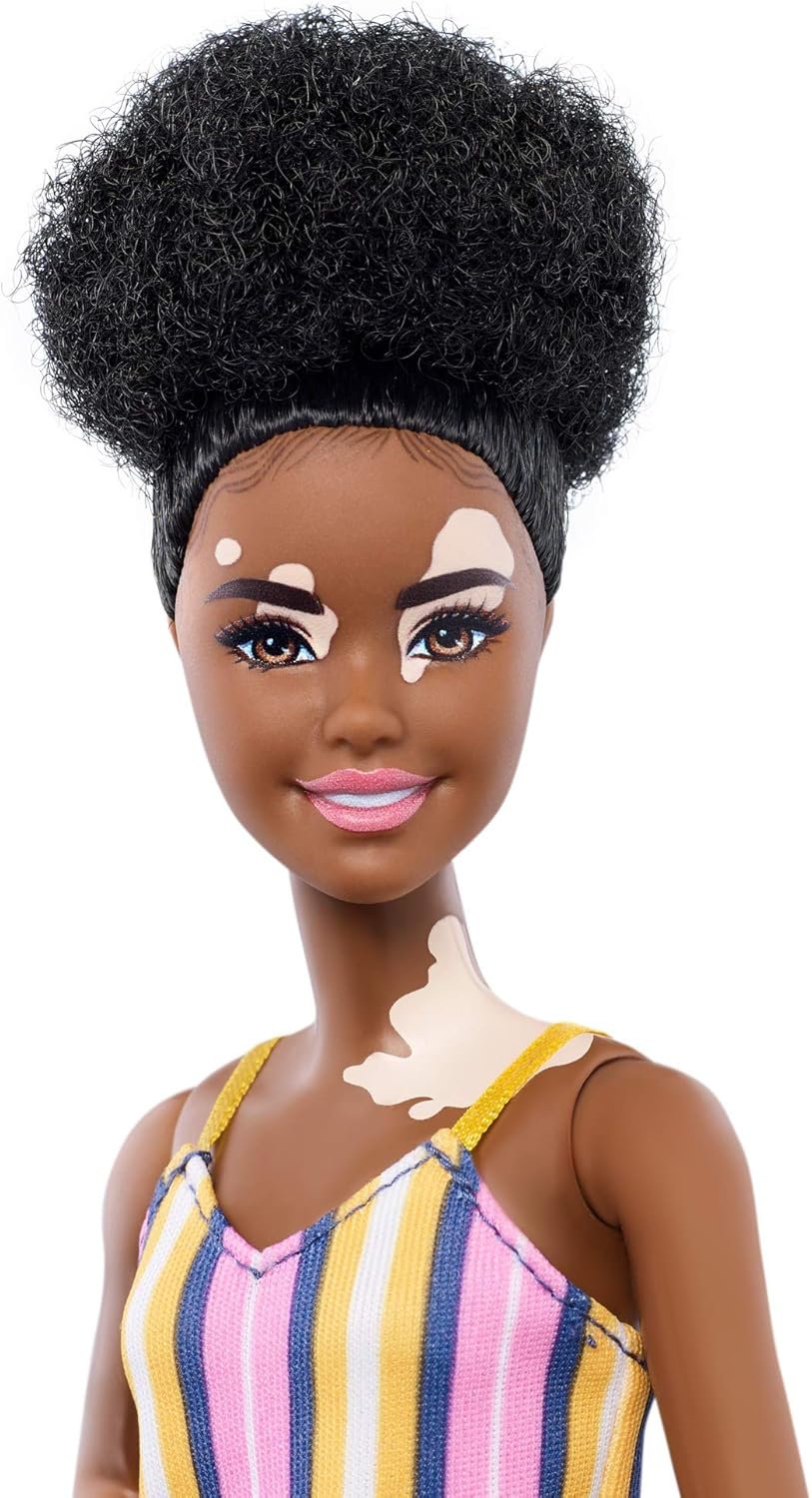 Amazon Com Barbie Fashionistas Doll With Vitiligo And Curly