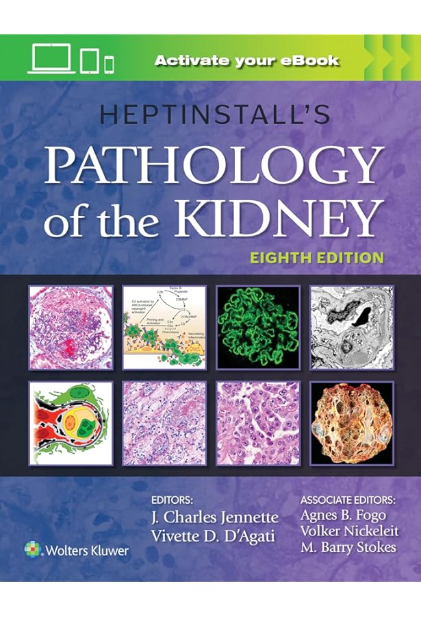 Diagnostic Pathology: Kidney Diseases: 9780443107177: Medicine
