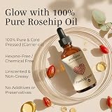 Cold Pressed Rosehip Oil Face & Body 100ml - Scars Acne Moisturizer view 2