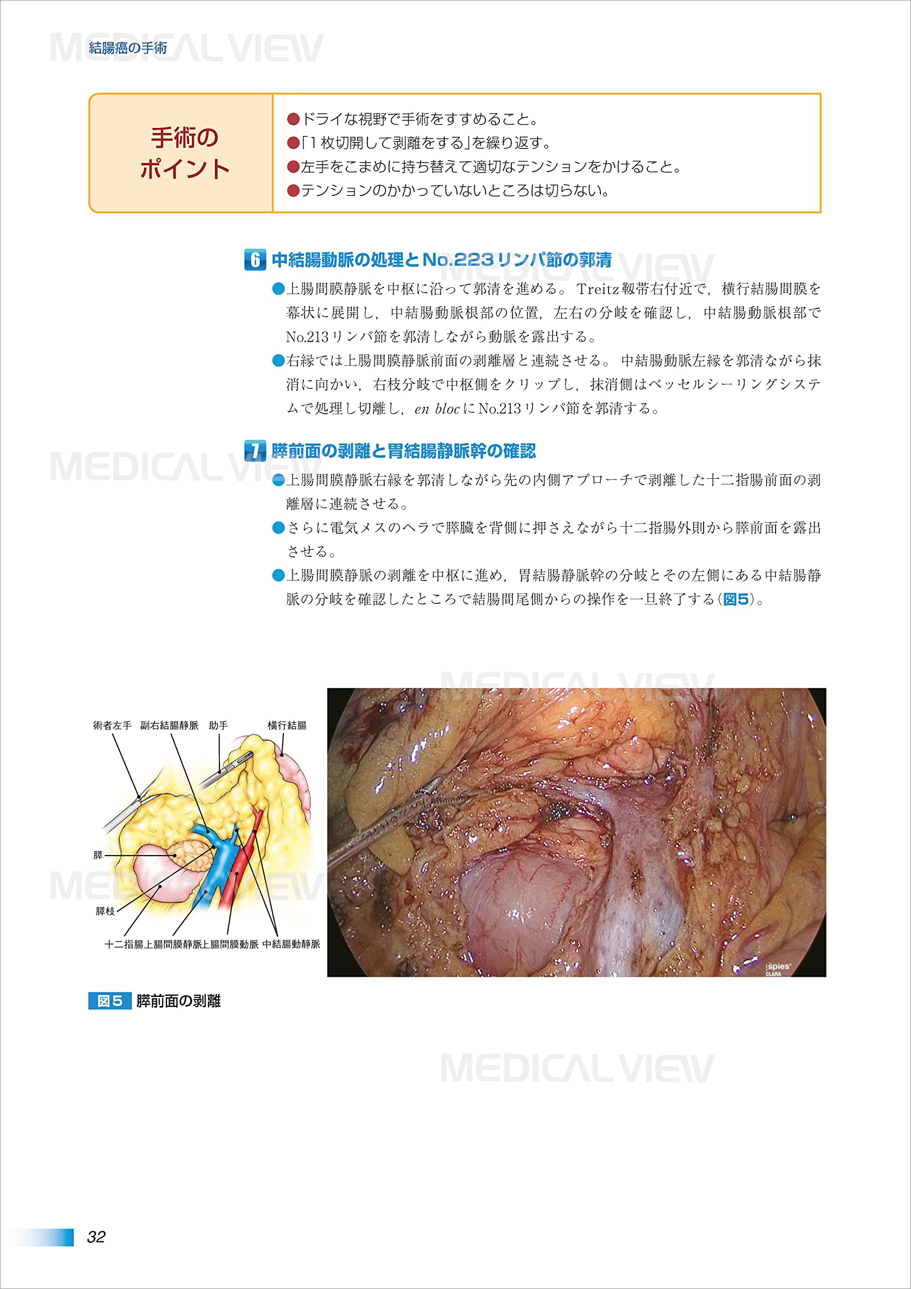 肝癌 (がん研スタイル癌の標準手術) sakuraproperty.co.uk