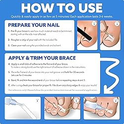 CurveCorrect® Ingrown Toenail Treatment Kit