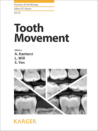 Download Tooth Movement (Frontiers of Oral Biology Book 18) (English Edition) PDF