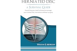 Herniated Disc: A Survival Guide: Everything you need to know to manage your lumbar disc herniation without surgery