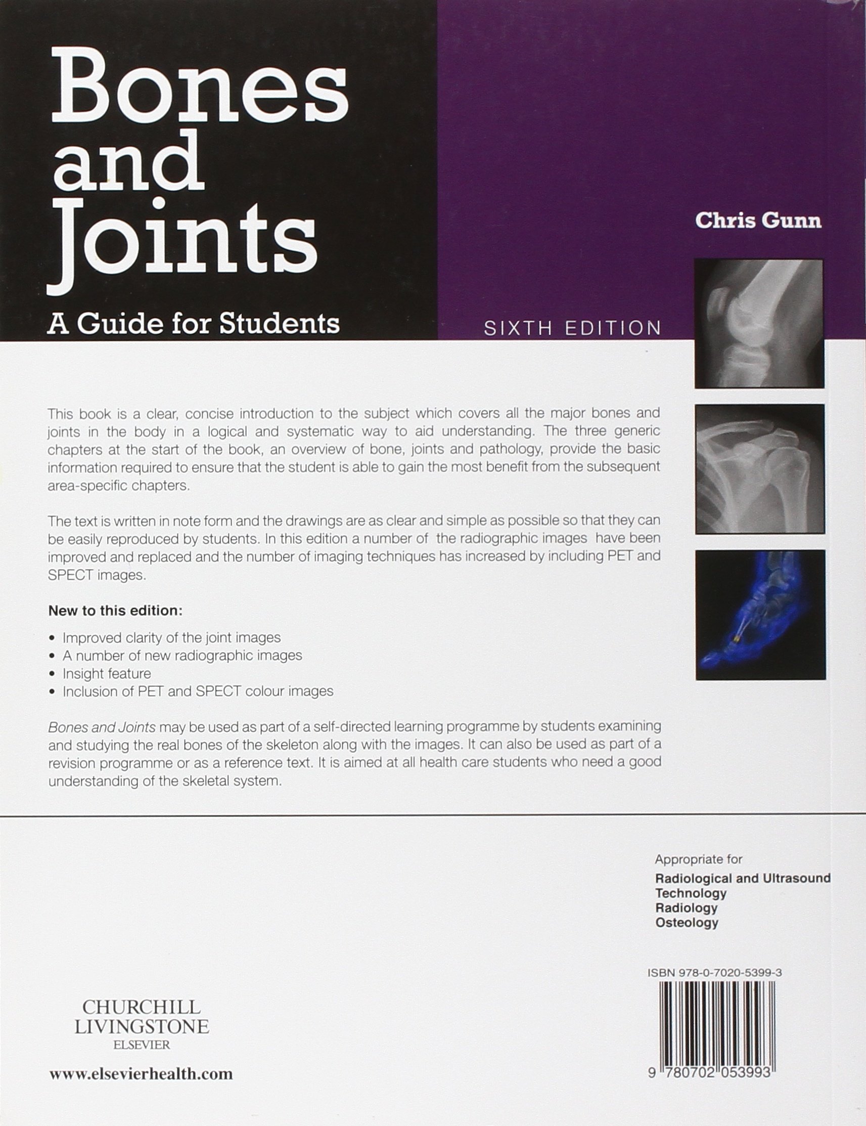 Bones And Joints A Guide For Students 6e Amazon Co Uk Gunn Ma Tdcr Chris Books