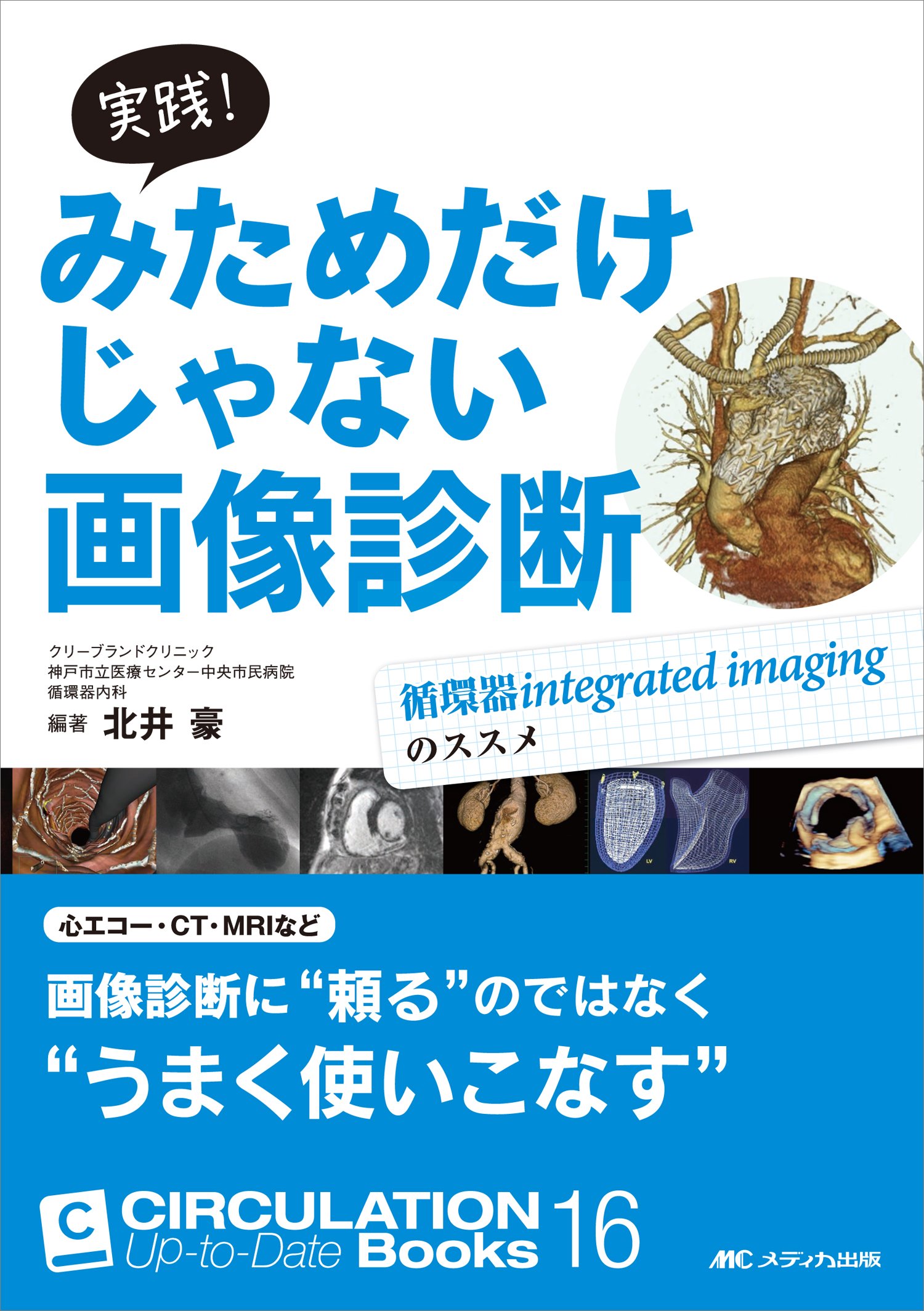 実践 みためだけじゃない画像診断 循環器integrated Imagingのススメ Circulation Up To Date Books 16 北井 豪 北井 豪 本 通販 Amazon
