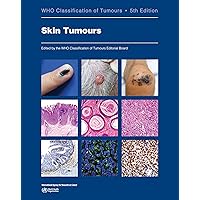 WHO Classification of Tumours of Haematopoietic and Lymphoid Tissues (World Health Organization Classification of Tumours) [ペーパーバック] Swerdlow， Steven H.、 Campo， Elias、 Harris， Nancy Lee、 Jaffe， Elaine WHO Classification of Tumours of Haematopoietic and Lymphoid