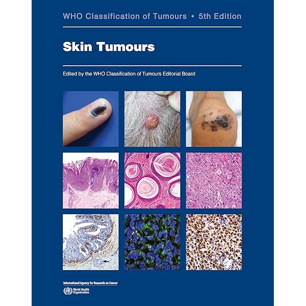 【未開封】WHO Classification of Tumours of En WHO Classification of Tumours of Haematopoietic and Lymphoid