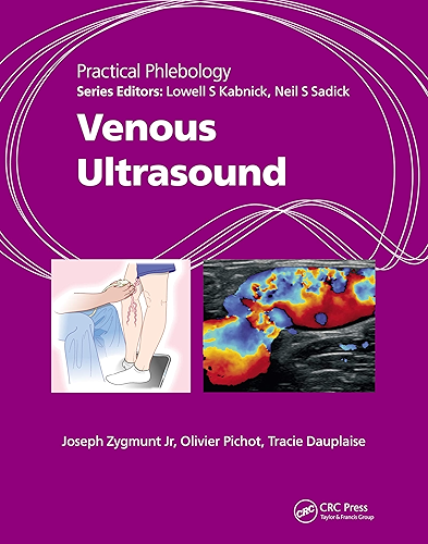 Download Practical Phlebology: Venous Ultrasound (English Edition) PDF