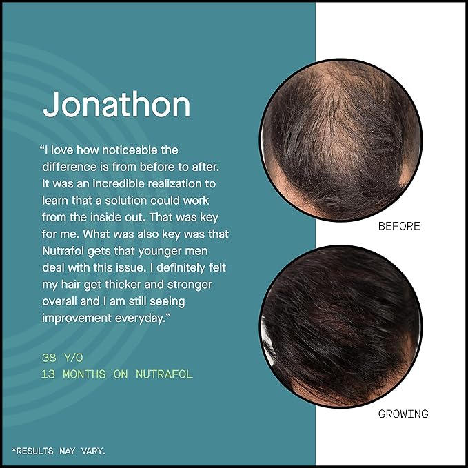Amazon Com Hair Loss Thinning Supplement Men S Hair Vitamin For