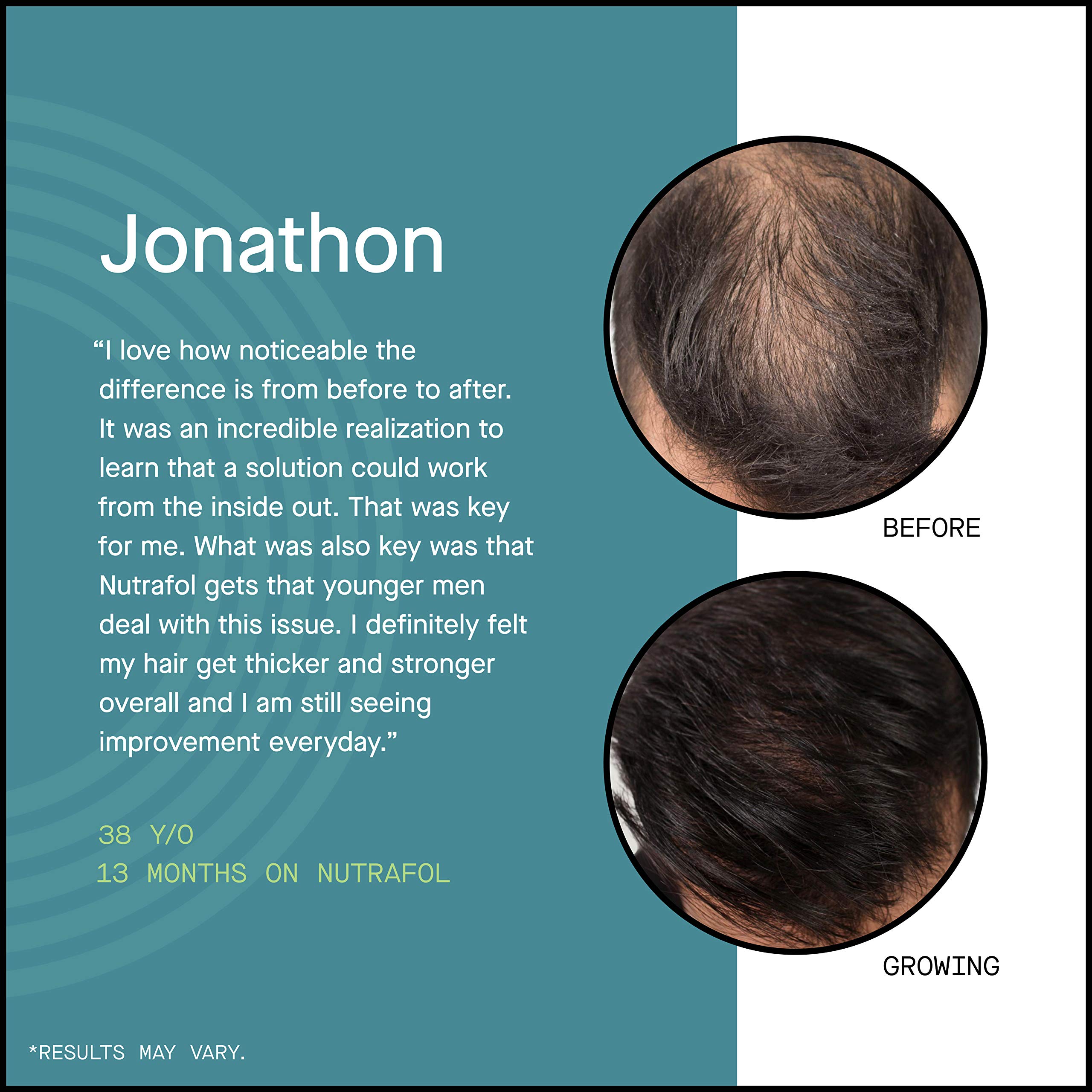 Hair Loss Thinning Supplement Men's Hair Vitamin for Thicker