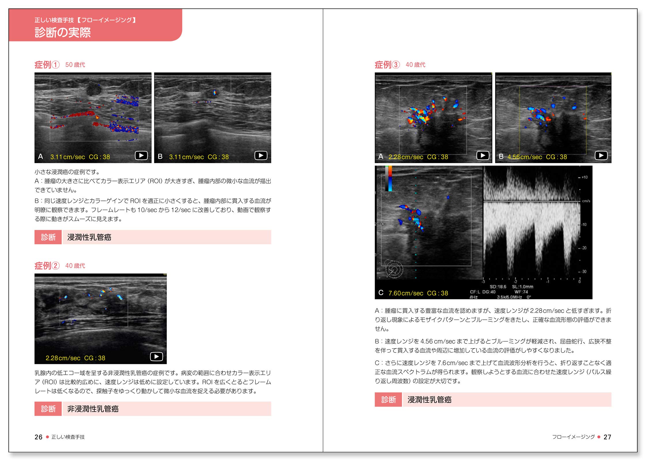 乳房超音波入門 動画で学ぶ厳選100症例 健康 医学 Www Bloompsychologyservices Com
