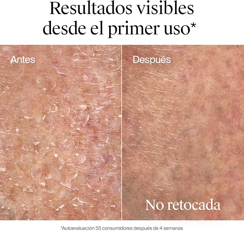 Neutrogena norwegian formula cica loção corporal reparação intensa para pele seca (embalagem de 2 x 750 ml), hidratante corporal reparador com centella asiática