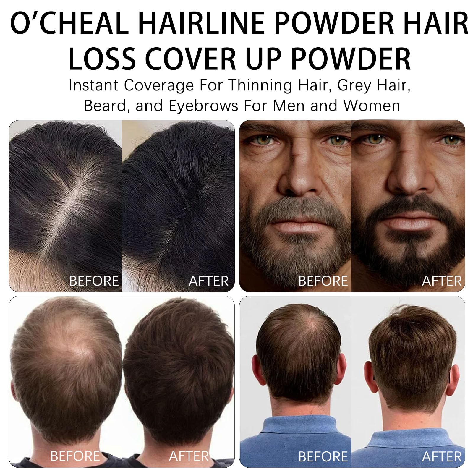 O'CHEAL Black Hairline Powder, Hair Loss Cover Up Powder, Hair Fibers for Thinning Hair, Instantly Root Touch Up Hair Color for Gray Hair Coverage, Sweatproof Hairline Shadow Powder for Men and Women