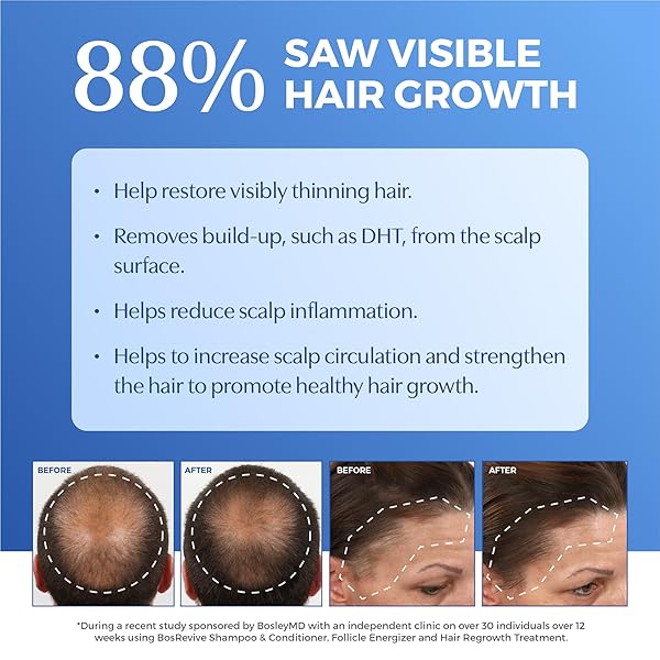BOSREVIVE VOLUMIZING CONDITIONER FOR NOTICEABLY THINNING, NON COLOR-TREATED HAIR – DHT-BLOCKING SAW PALMETTO, BIOTIN STRENGTHENING, NIACIN REVITALIZING & PANTHENOL, VEGAN, SULFATE-FREE 10.1 FL OZ