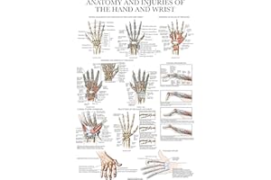 PALACE LEARNING Laminated Anatomy and Injuries of the Hand and Wrist Poster - Hand and Wrist Joint Anatomical Chart - 18" x 24"