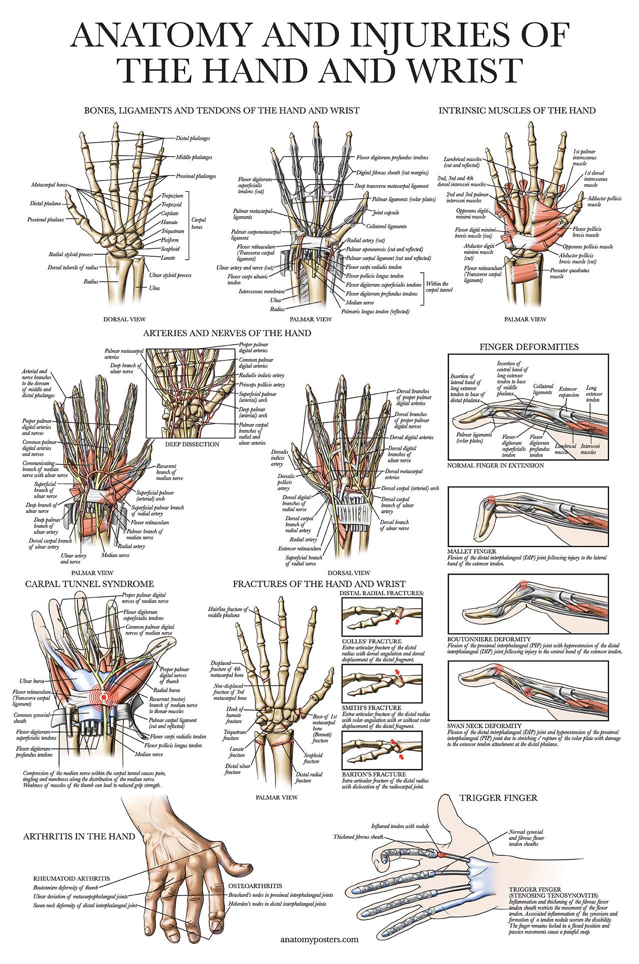 Palace Learning Laminated Anatomy and Injuries of the Hand and Wrist Poster - Hand and Wrist Joint Anatomical Chart - 18" x 24"