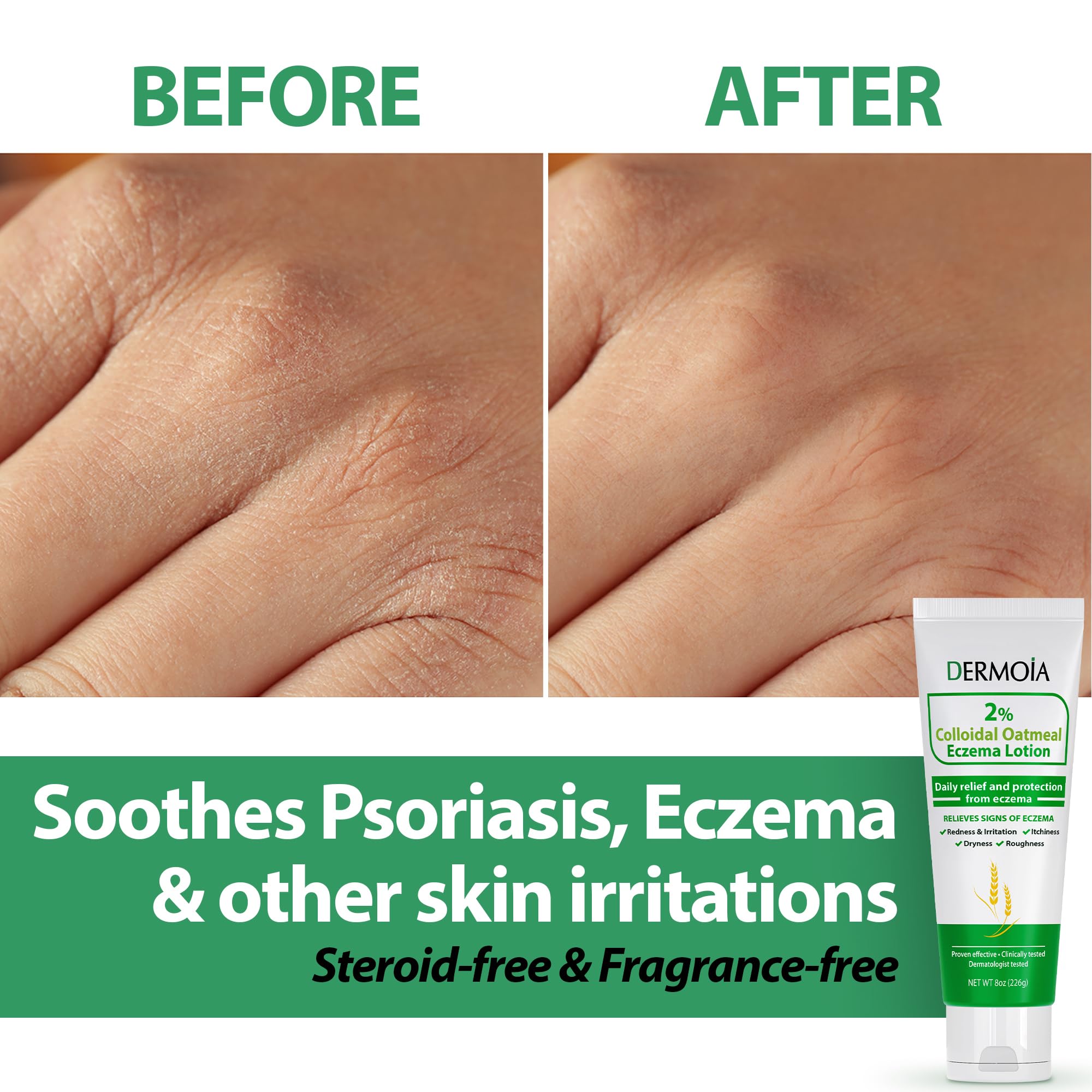 2% Colloidal Oatmeal Eczema Lotion - Soothing and Moisturizing Anti-Itch Cream & Body Lotion with Aloe Vera, Shea and Glycerin - Nourishing Eczema Cream for Superior Relief and Protection 8oz