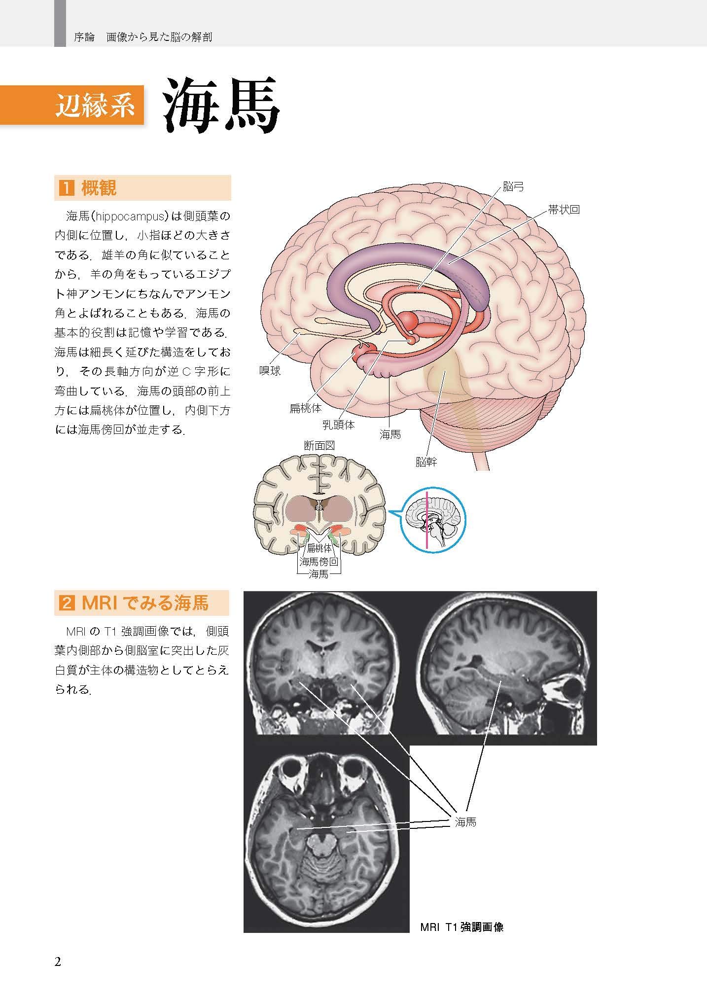 認知症イメージングテキスト 画像と病理から見た疾患のメカニズム 冨本 秀和 松田 博史 羽生 春夫 吉田 眞理 本 通販 Amazon