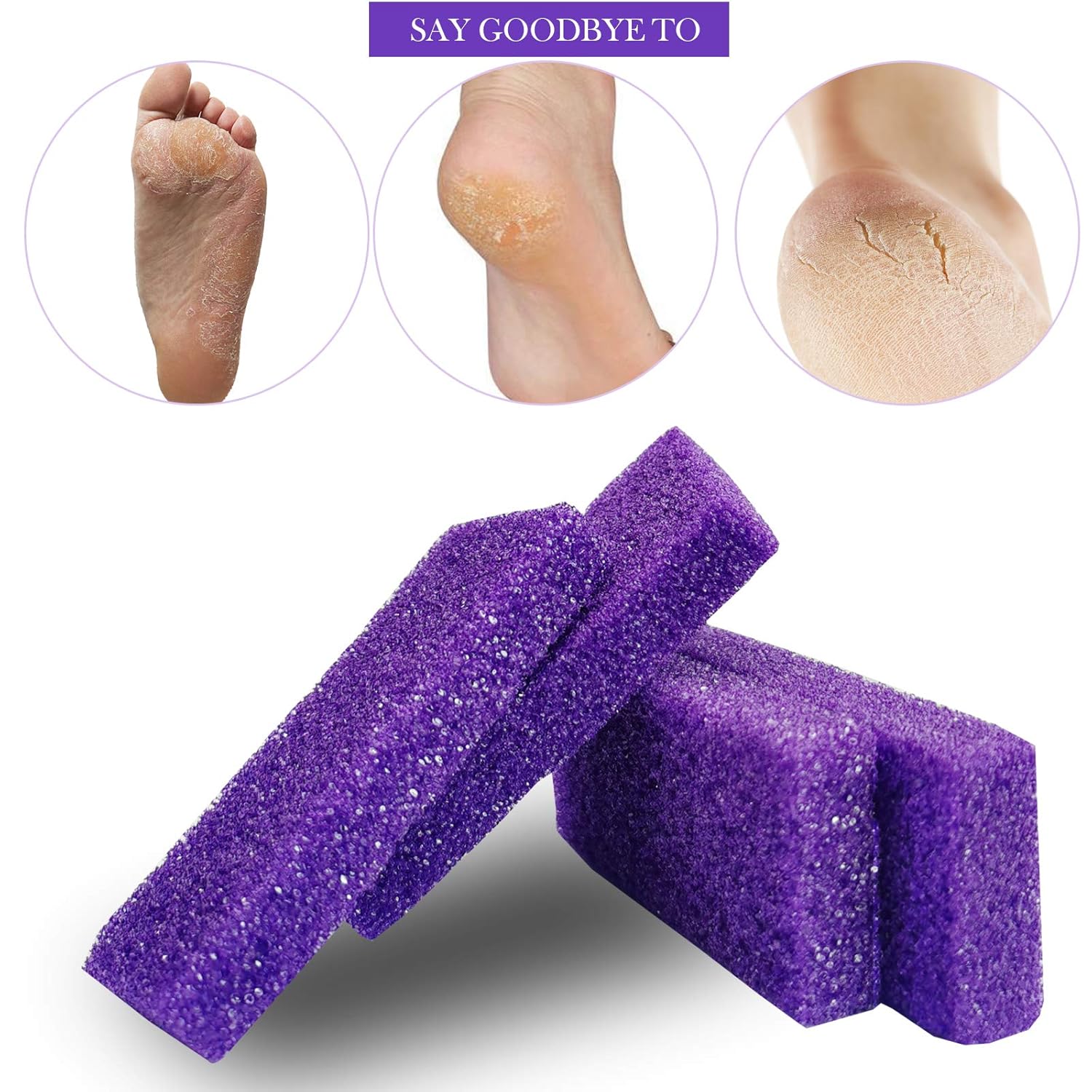 40 Pcs Pumice Stone For Feet Foot Scrubber Sponge For Feet Care and Callus Remover Mini Disposable Pumice Pads For Dead Skin Remover Purper.: Beauty