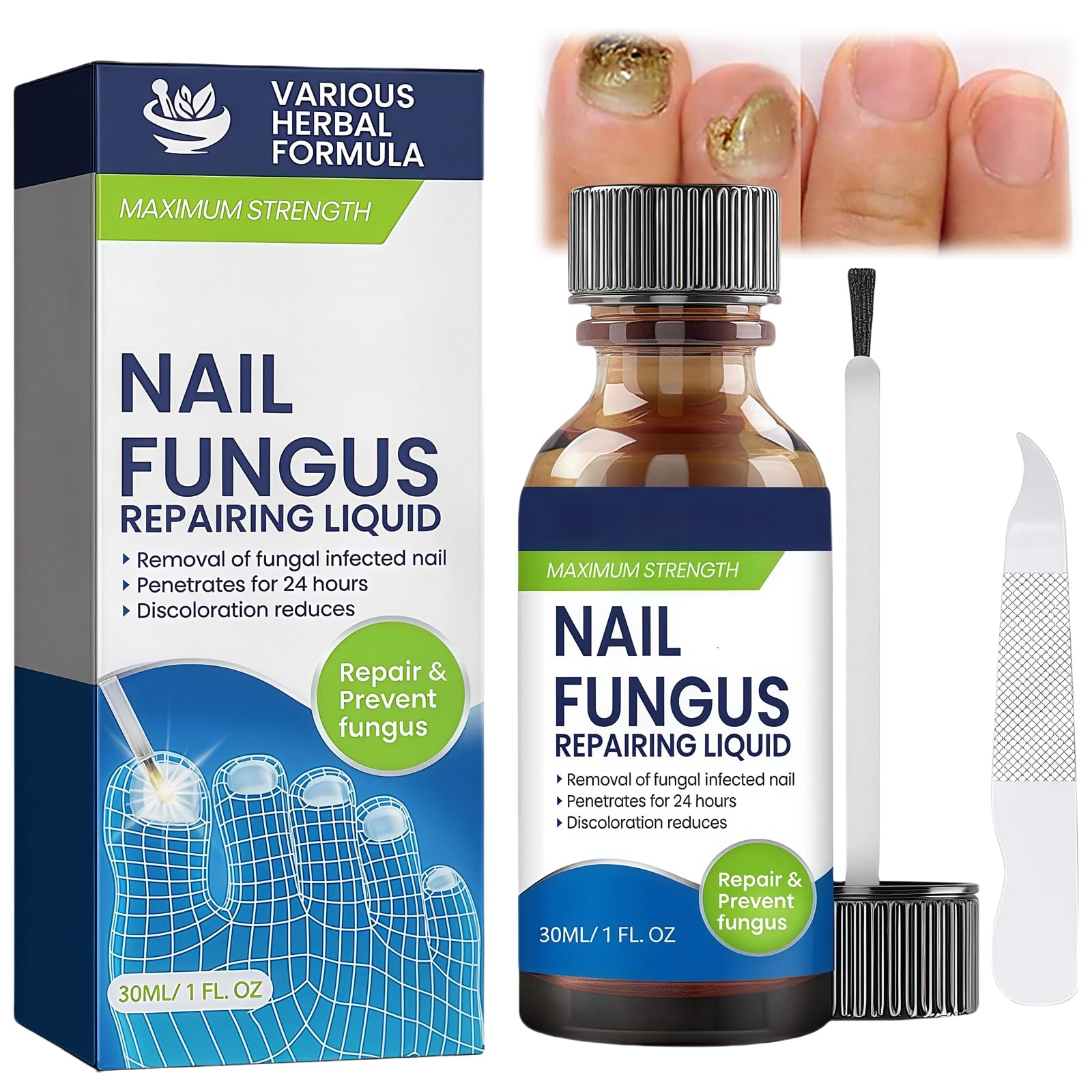 Nail Repairing Liquid, Speedy and Effective Approach to Toenail Issues - Combating Thick, Discolored Nails - Powerful Solution for Addressing Yellow and Brown Nails