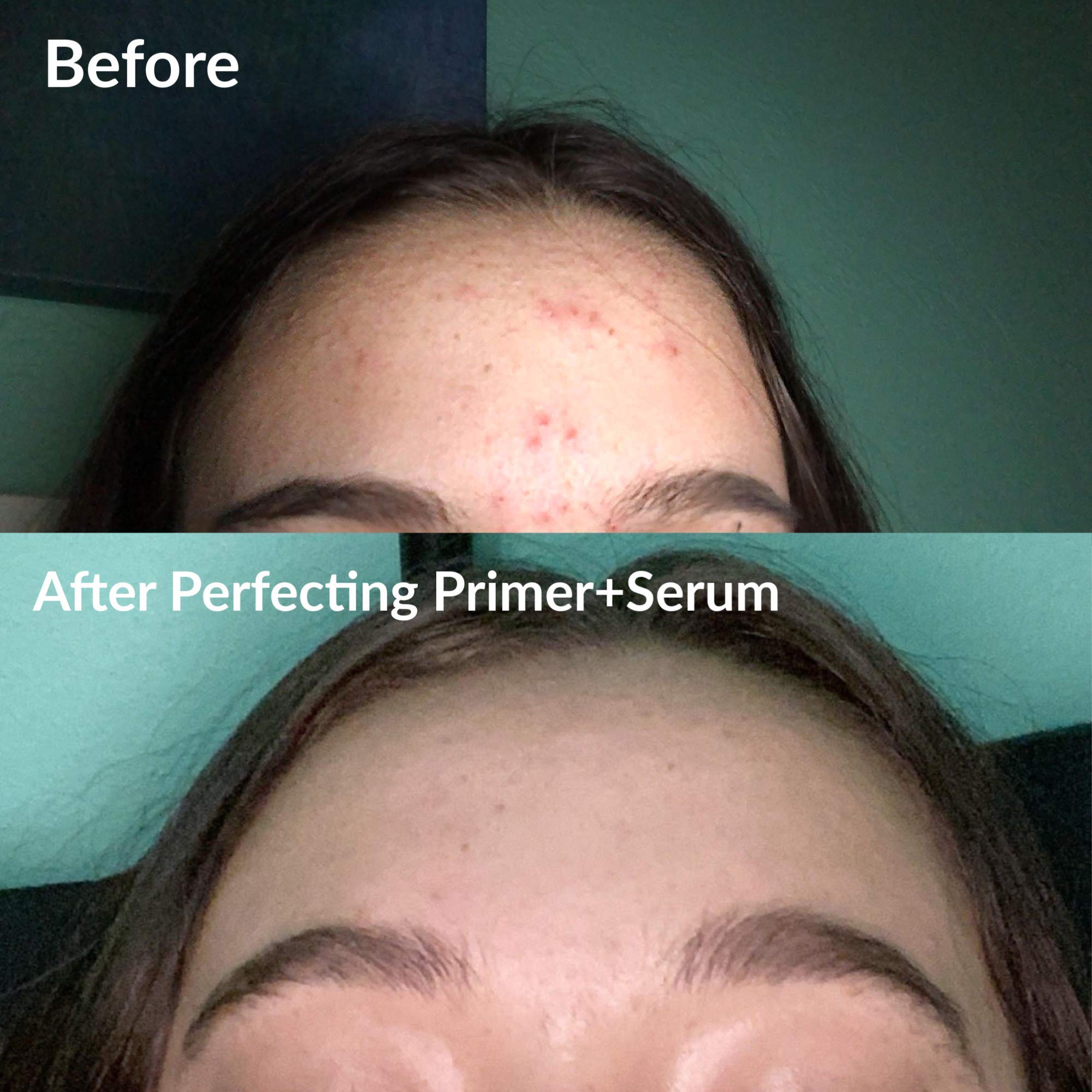 Frilliance 2 in 1 Clear Skin Perfecting Primer & Serum for Acne, Vegan Cruelty Free for Teens of All Skin Types, Mandelic Acid & Niacinamide Fights Breakouts Blackheads, 15 ml / .5 fl oz